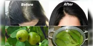 Read more about - পেয়ারা পাতার জাদুতেই মিটবে চুল পড়ার সমস্যা, কীভাবে জানেন?