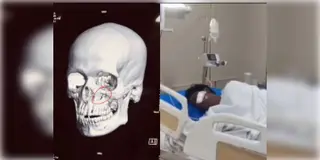 Read more about - Khagen Murmu | খগেন মুর্মু হামলা কান্ডে রাজ্যের কাছে রিপোর্ট তলব! দ্রুত না দিলে নেওয়া হবে আইনি পদক্ষেপ!