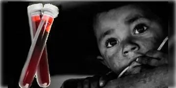 Read more about - ন্যাশানাল ফ্যামিলি হেলথ সার্ভের পরিসংখ্যান অনুযায়ী, রক্তাল্পতায় ভুগছে ভারতের অধিকাংশ শিশু ও মহিলা।