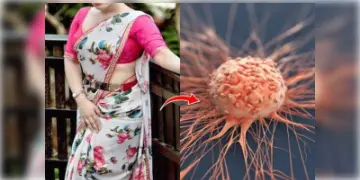 Read more about - Saree Cancer | শক্ত করে বেঁধে রাখা পেটিকোটের দড়ির জন্য পড়ে গিয়েছে কালশিটে? এক্ষুণি সতর্ক না হলে হতে পারে 'শাড়ি ক্যানসার'!