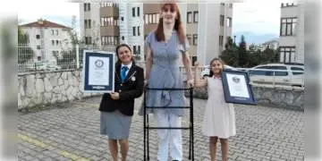 Read more about - গিনেস বুকে নাম লেখালেন তুরস্কের রুমেইশা, বিশ্বের সব চেয়ে লম্বা মহিলা!