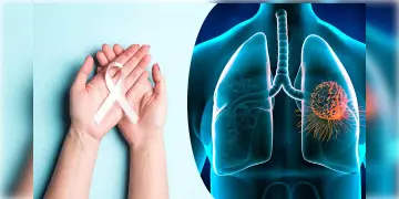 Read more about - World Lung Cancer Day | দীর্ঘস্থায়ী কাশি, বুকে ব্যথা? হতে পারে ফুসফুসের ক্যান্সার!