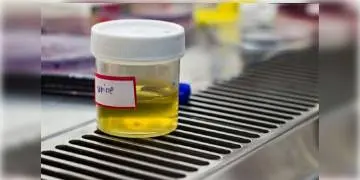 Read more about - আপনি ডায়াবিটিস আক্রান্ত কিনা তা বলে দেবে আপনার প্রস্রাবের রং