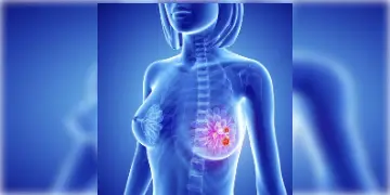 Read more about - Breast Cancer: রক্ত পরীক্ষা করালেই জানতে পারবেন আপনি স্তন ক্যানসারে আক্রান্ত কি না!