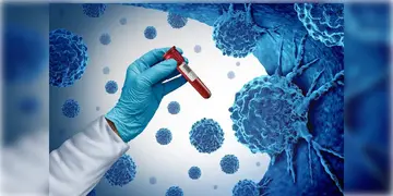 Read more about - Cancer Blood Test | একটি রক্ত পরীক্ষাতেই শনাক্ত করা যাবে ৩০ ধরনের ক্যানসারকে! মিলবে ৯৮.৪ শতাংশ নির্ভুল ফলাফল!