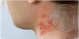 Read more about - আপনার শরীরে কি ভিটামিনের ঘাটতি আছে ? আপনার মুখই বলে দেবে সেই কথা, কিভাবে? জানুন ...