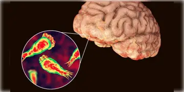 Read more about - Kerala brain-eating amoeba । কেরলে ২ মাসে ৩ জনের প্রাণ কাড়লো ‘মস্তিষ্ক ভক্ষণকারী অ্যামিবা’!