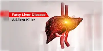 Read more about - Fatty Liver Cirrhosis: ফ্যাটি লিভারের প্রধান ৫টি প্রতিরোধ জানুন ও সতর্ক থাকুন