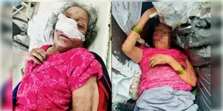 Read more about - Mumbai | ক্যান্সার আক্রান্ত বৃদ্ধাকে আবর্জনার স্তূপে ফেলে গেলো নাতি! নিষ্ঠুর ঘটনা মুম্বইয়ে!