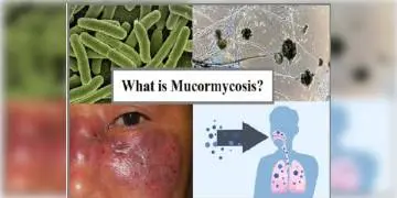 Read more about - মারণ ছত্রাকের নাম 'মিউকরমাইকোসিস' , একগুচ্ছ সতর্কতা জারি করল কেন্দ্রীয় স্বাস্থ্য মন্ত্রক