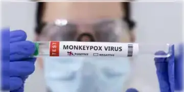 Read more about - MPOX | HMPVর উদ্বেগের মাঝেই চিনে এবার হদিশ মিললো মাঙ্কিপক্সের নয়া স্ট্রেনের