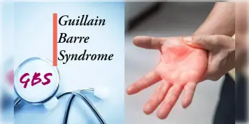 Read more about - Guillain Barre Syndrome | আতঙ্কের নয়া নাম গুলেন ব্যারি সিনড্রোম! কীভাবে হচ্ছে এই বিরল স্নায়ু রোগ? কারাই বা আক্রান্ত হচ্ছেন বেশি?