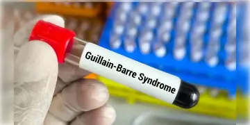 Read more about - Guillain Barre Syndrome | গুলেন বেরি সিনড্রোমে রাজ্যে মৃত্যু দুজনের! দ্বাদশ শ্রেণীর পড়ুয়ার পর বিরল স্নায়ুরোগে মৃত্যু এবার প্রৌঢ়র