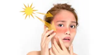 Read more about - Tan Removal Pack | ট্যান দূর না করলে ত্বক পুড়ে কালো তো হবেই, সঙ্গে হতে পারে ত্বকের নানা সমস্যাও! দেখুন বাড়িতে কীভাবে বানাবেন ট্যান রিমুভ্যাল প্যাক!